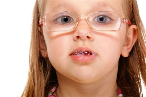 Seven Tips To Stop Your Child With Special Needs From Drooling Speech