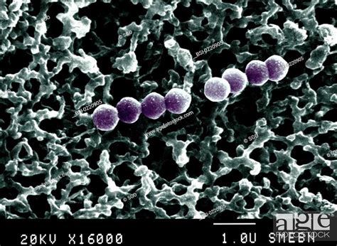 Streptococcus Pneumoniae Electron Micrograph