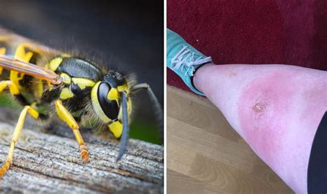 Show Me A Picture Of A Wasp Sting Picturemeta