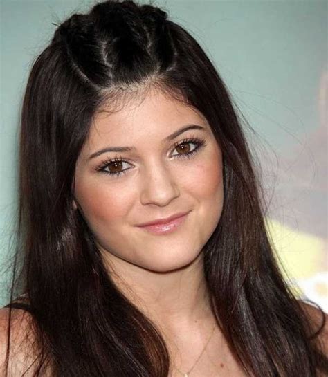 Before and After pictures - Kylie Jenner plastic surgery ...