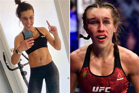 Joanna Jedrzejczyk Shares Picture Of Her Face On Instagram As She Recovers From Horrific