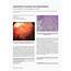 PDF Gastrointestinal Amyloidosis And Multiple Myeloma