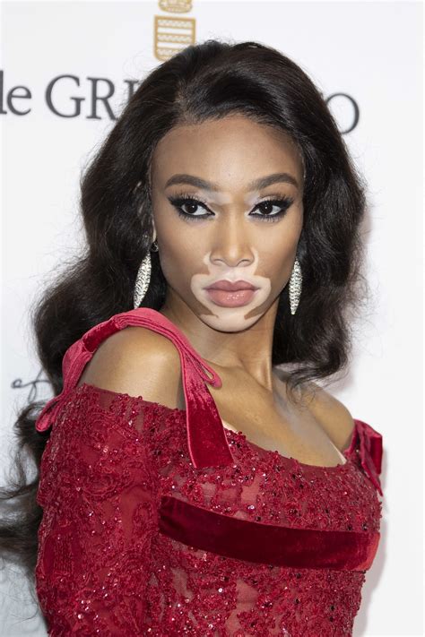 Winnie Harlow Pictures Hotness Rating Unrated