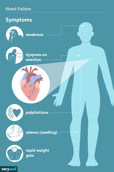 Symptoms and Complications of Heart Failure | Heart failure symptoms, Heart failure, Failure