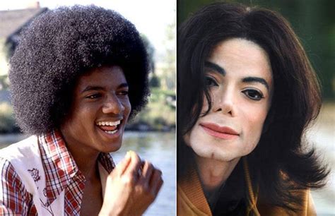 The Unforgettable Michael Jackson Before And After Plastic Surgery