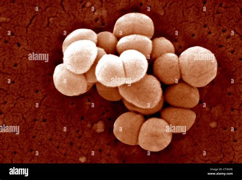 Diplococci Bacteria High Resolution Stock Photography And Images Alamy