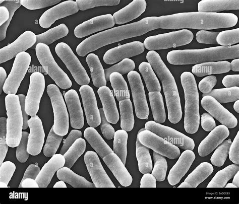 Scanning Electron Micrograph Sem Of Salmonella Typhi Is A Gram