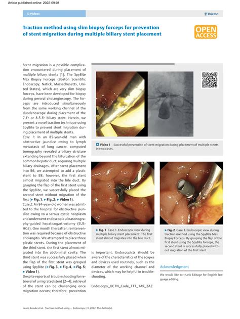 Pdf Traction Method Using Slim Biopsy Forceps For Prevention Of Stent