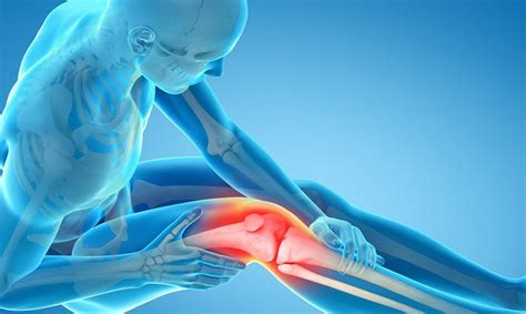 How Do Doctors Diagnose Knee Pain