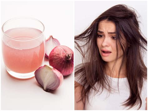 Because cell damage causes aging, consisting of prematurely gray hair onion juice not only helps in treating cold but also promotes hair growth. Here's how you can reverse hair fall with onion juice ...