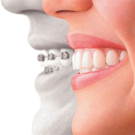 Best Orthodontist Dental Services In Dubai Dosula