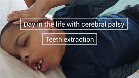 Day In The Life With Cerebral Palsy Teeth Extraction And Recovery