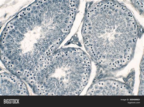 cross section human testis under microscope view shows spermatogonia spermatocytes in meiosis