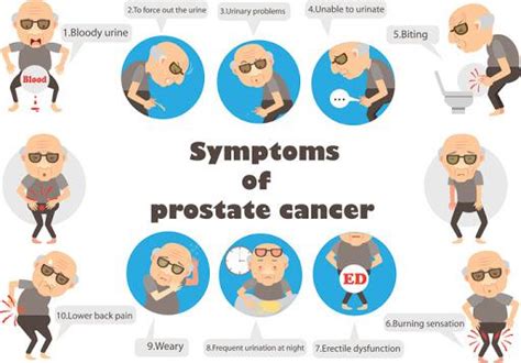 Prostate Cancer Symptoms Coolguides