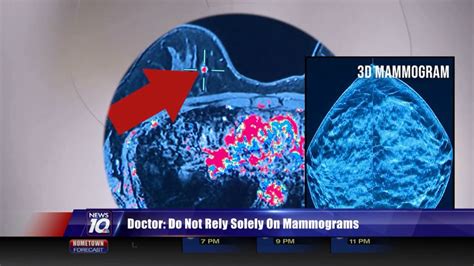 Doctor Dont Rely Solely On Mammograms For Dense Breasts