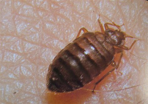 Horrific Mother ‘eaten Alive In Her Home By Thousands Of Bed Bugs