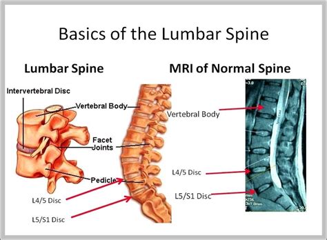 Pictures Of Lumbar Spine Graph Diagram