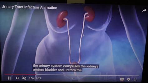 Urinary Tract Infection By Medical Doctor Youtube