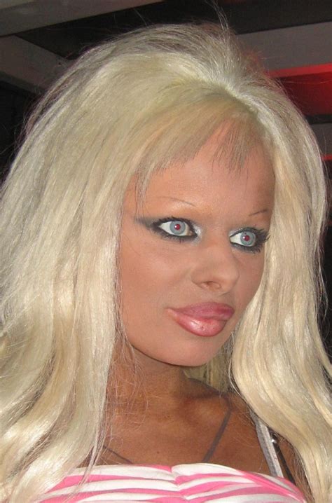Plastic Surgery Fails - Just DON'T Do It!!