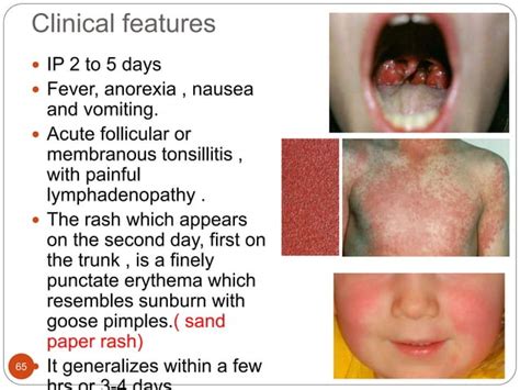 Staphylococcal And Streptococcal Skin Infections Ppt