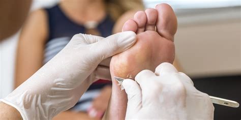 Chiropody Foot Care Experts The Healthcare Hub