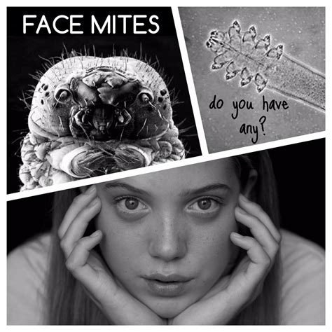 The Secrets Of Face Mites Face Mites Are Microscopic Bugs On Your Skin
