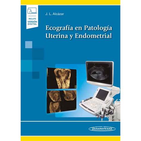 Alcázar Ecografía En Patología Uterina Y Endometrial 1 Ed 2021