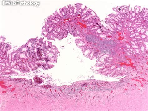 A Collection Of Surgical Pathology Images