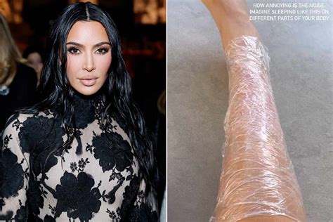 Kim Kardashian Shares How She Deals With Psoriasis