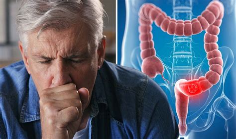 Bowel Cancer Symptoms Include A Cough That Doesnt Go Away And Blood