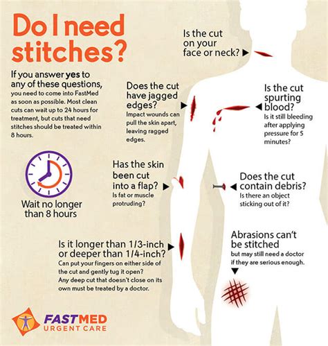 Do I Need Stitches Infographic Fastmed