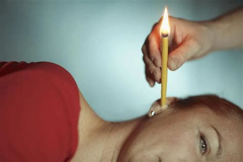 Ear Candling Safety And Side Effects Ear Candling Ear Wax Candle