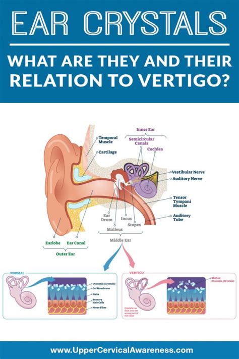 Ear Crystals What Are They And Their Relation To Vertigo