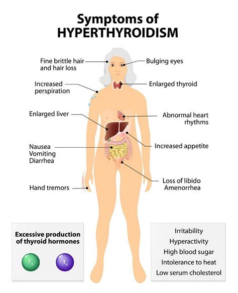 Thyroid Gland Functions Location Hormones With Overactive