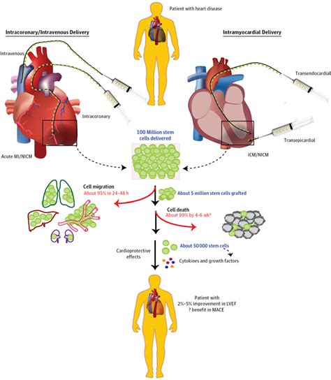 Stem Cell Regenerative Therapy For Cardiovascular Disease Stem Cell