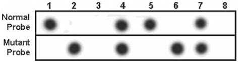 Hruban rh, van mansfeld ad, offerhaus gj, et al. Example of allele-specific oligonucleotide dot blot ...