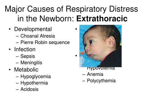 Ppt Respiratory Distress In The Newborn Not Rds Powerpoint