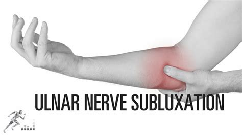 What Can Be Done For Ulnar Nerve Subluxation Of The Elbow Youtube