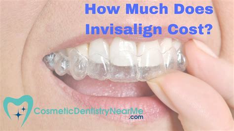 Please see details of our prices for invisalign in the cost guide. How much does Invisalign® cost? - YouTube