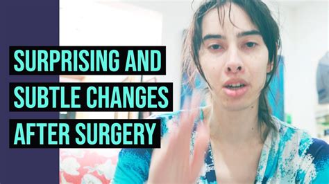 Surprising And Subtle Changes After Surgery MTF Transgender FFS Breast Augmentation YouTube