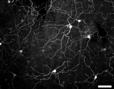 Photoreceptive Net In The Mammalian Retina Nature