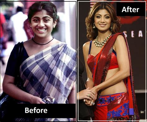 Bollywood Celebrities Before And After Plastic Surgery Part I Funsack