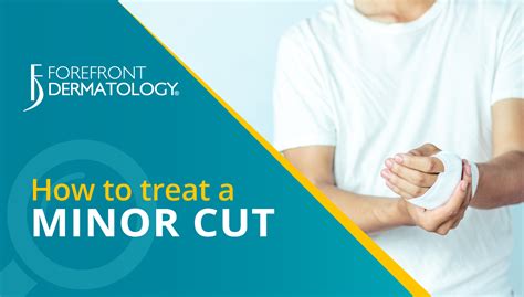 How To Treat A Minor Cut In 4 Steps Forefront Dermatology
