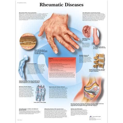 Anatomical Charts and Posters - Anatomy Charts - Geriatric Health Charts - Rheumatic Disease ...