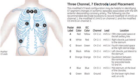 Diagnostic Ecg Lead Placement Clinical View