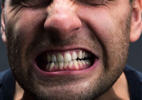 Reasons Youre Clenching Your Teeth And How To Stop Williamsburg Dental