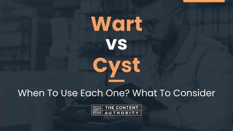 Wart Vs Cyst When To Use Each One What To Consider