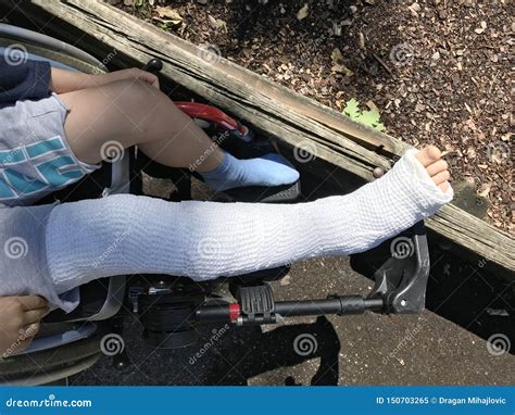 Boy With Broken Leg Sitting In The Wheelchair Stock Image Image Of