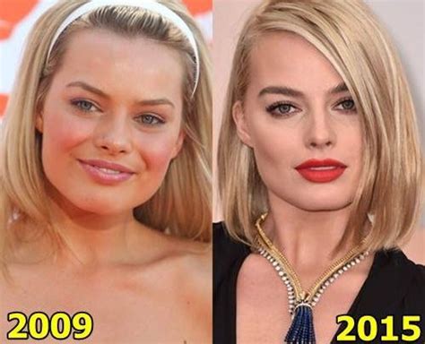 She has received nominations for two academy awards, four golden globe awards. Margot Robbie Better look after plastic surgery?
