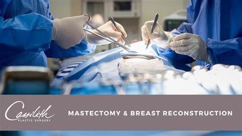 mastectomy and breast reconstruction surgery explained by dr cassileth youtube